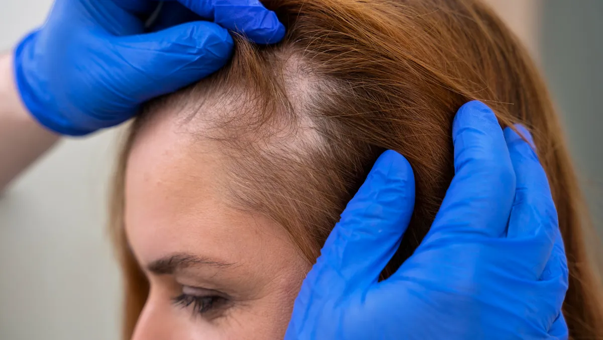 scalp peels & rejuvenation treatment