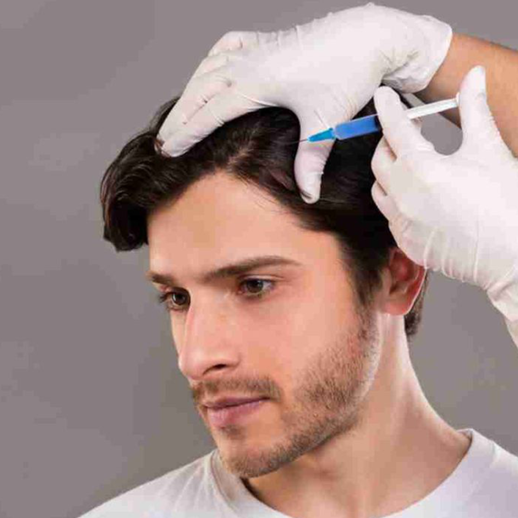 PRP Hair Treatment in Chennai