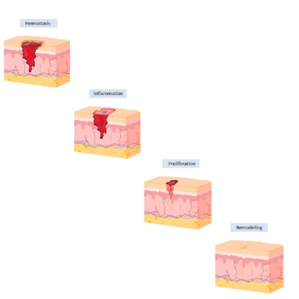 skin healing stages through microneedling treatment in Chennai